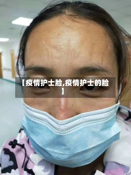 【疫情护士脸,疫情护士的脸】-第3张图片
