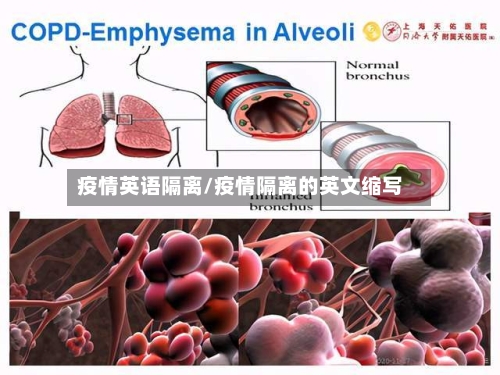 疫情英语隔离/疫情隔离的英文缩写-第2张图片