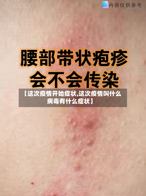 【这次疫情开始症状,这次疫情叫什么病毒有什么症状】