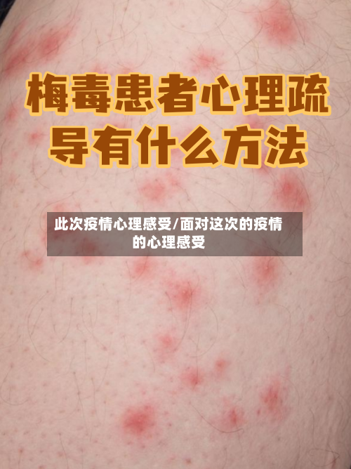 此次疫情心理感受/面对这次的疫情的心理感受-第3张图片