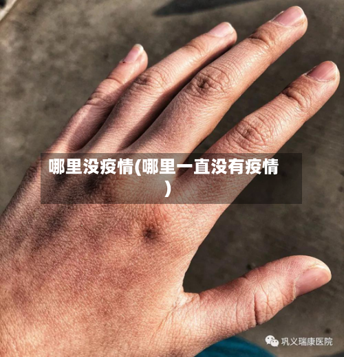 哪里没疫情(哪里一直没有疫情)-第2张图片