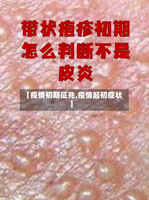 【疫情初期征兆,疫情起初症状】