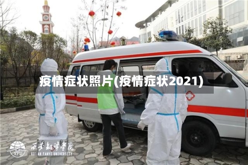 疫情症状照片(疫情症状2021)