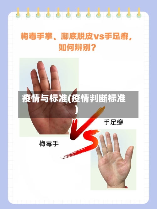 疫情与标准(疫情判断标准)