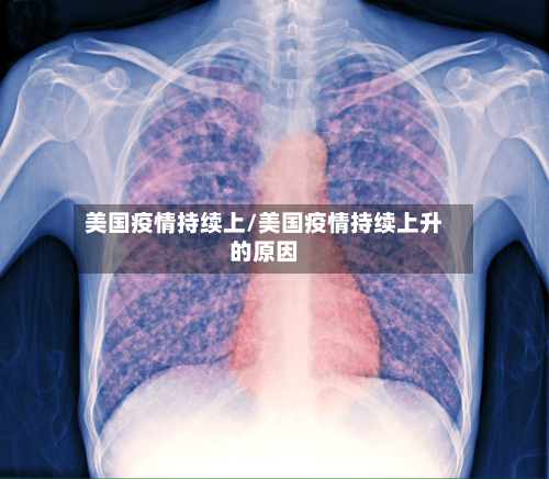 美国疫情持续上/美国疫情持续上升的原因