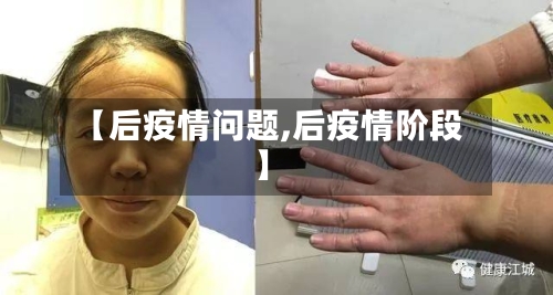 【后疫情问题,后疫情阶段】-第3张图片