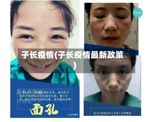 子长疫情(子长疫情最新政策)