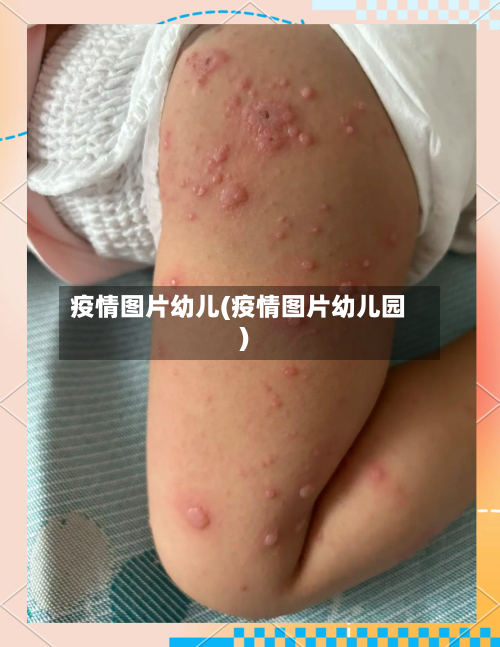 疫情图片幼儿(疫情图片幼儿园)
