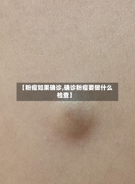 【粉瘤如果确诊,确诊粉瘤要做什么检查】-第2张图片