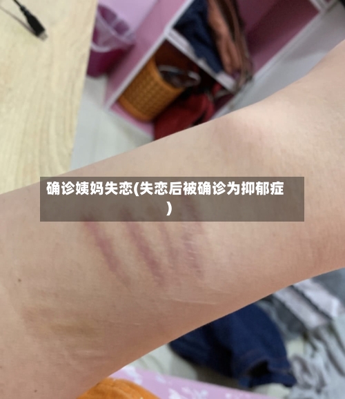 确诊姨妈失恋(失恋后被确诊为抑郁症)-第2张图片