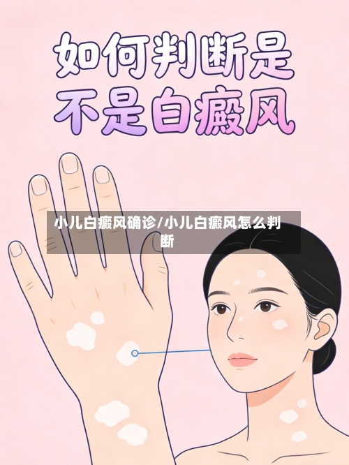 小儿白癜风确诊/小儿白癜风怎么判断