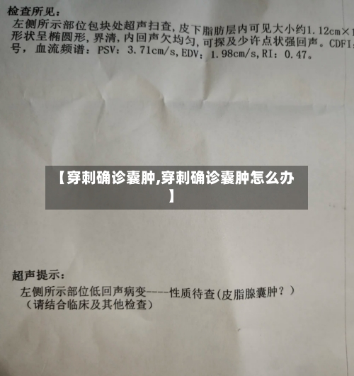 【穿刺确诊囊肿,穿刺确诊囊肿怎么办】-第2张图片