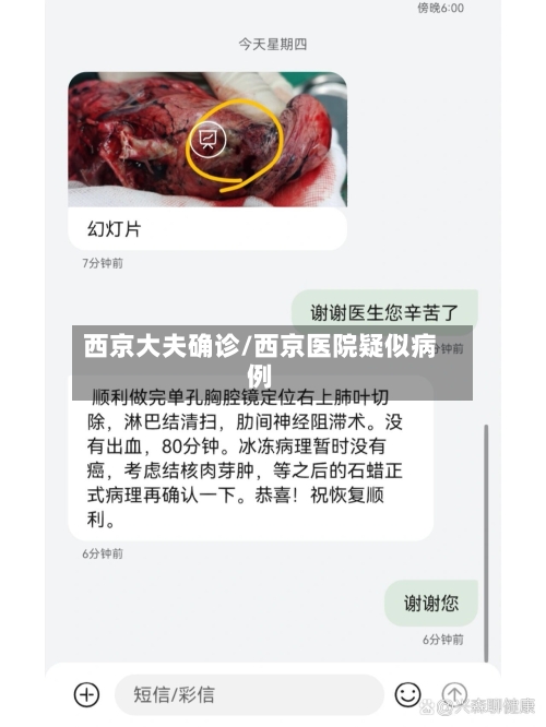 西京大夫确诊/西京医院疑似病例-第2张图片
