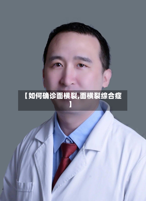 【如何确诊面横裂,面横裂综合症】