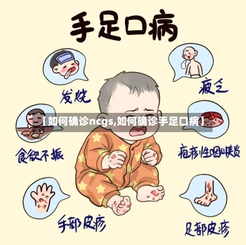 【如何确诊ncgs,如何确诊手足口病】