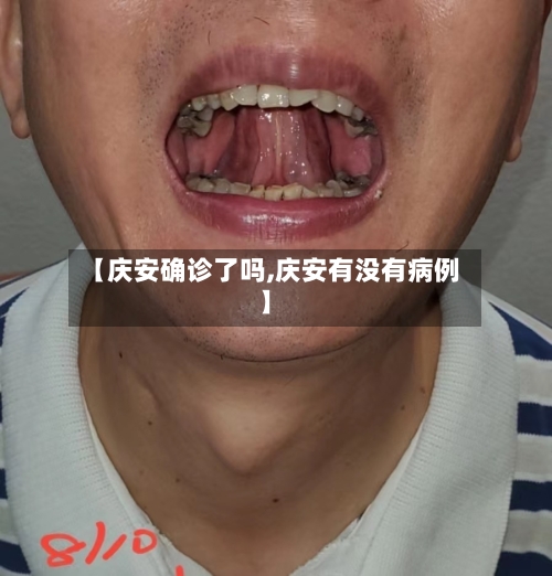 【庆安确诊了吗,庆安有没有病例】-第2张图片