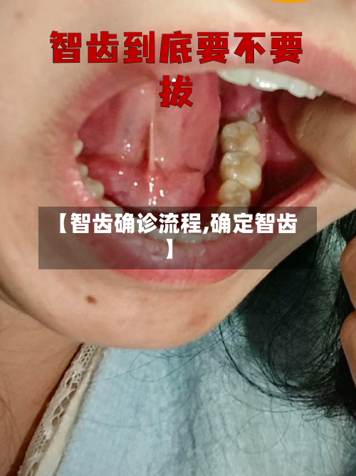 【智齿确诊流程,确定智齿】-第2张图片