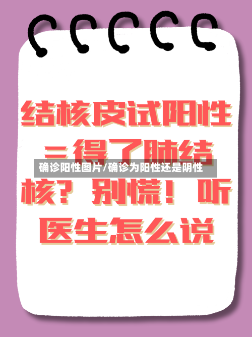 确诊阳性图片/确诊为阳性还是阴性