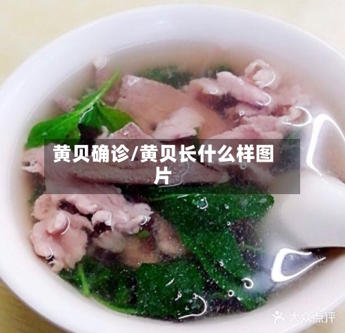 黄贝确诊/黄贝长什么样图片