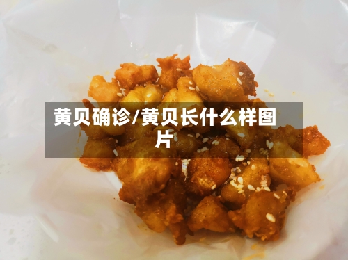 黄贝确诊/黄贝长什么样图片-第3张图片