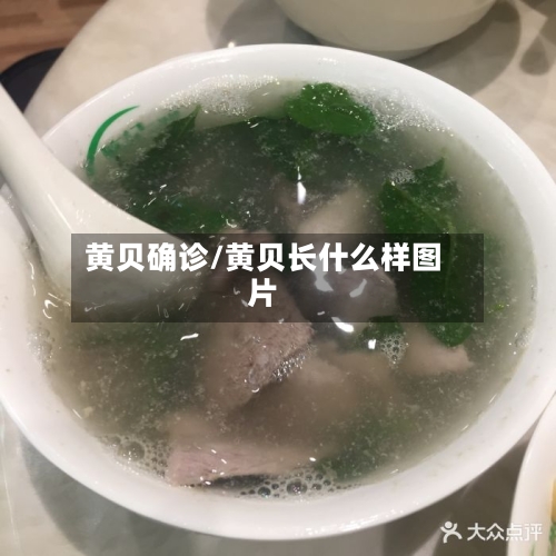 黄贝确诊/黄贝长什么样图片-第2张图片