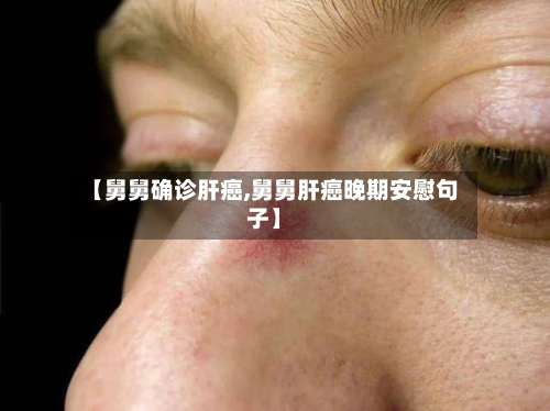 【舅舅确诊肝癌,舅舅肝癌晚期安慰句子】-第2张图片
